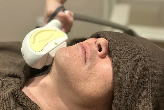 足脱毛